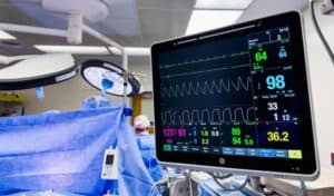 What is Cardiac Monitoring? Purpose and Types of Cardiac Monitor Machines in Pakistan